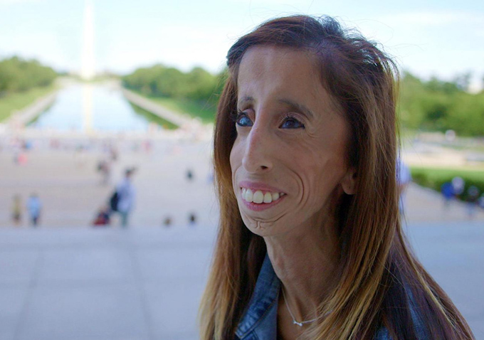 A Brave Heart: The Lizzie Velasquez Story