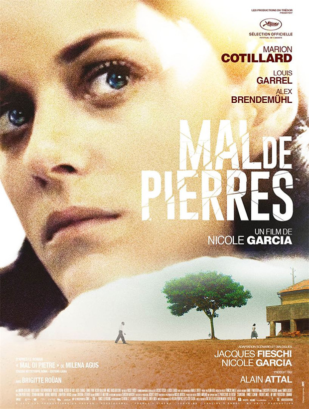Mal-de-pierres-1